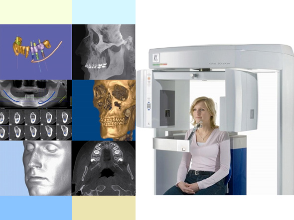 最先端の歯科用3D-CTを導入し、病気の診断やインプラント治療などに役立てています。歯科用3D-CTを用いることで3Dの立体的な画像情報を得ることができます。